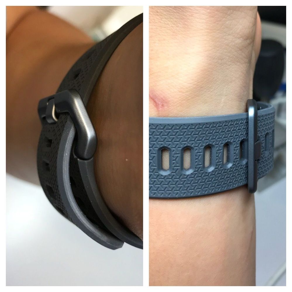 Band clasp does not sit flush on ionic band Fitbit Community