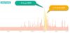 active minutes graph 21jan18.jpg