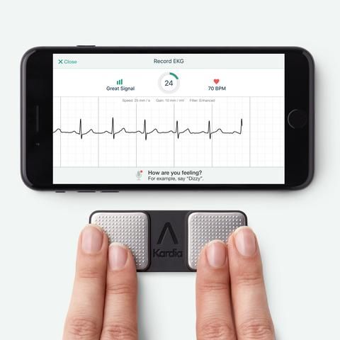 Fitbit that does online ekg