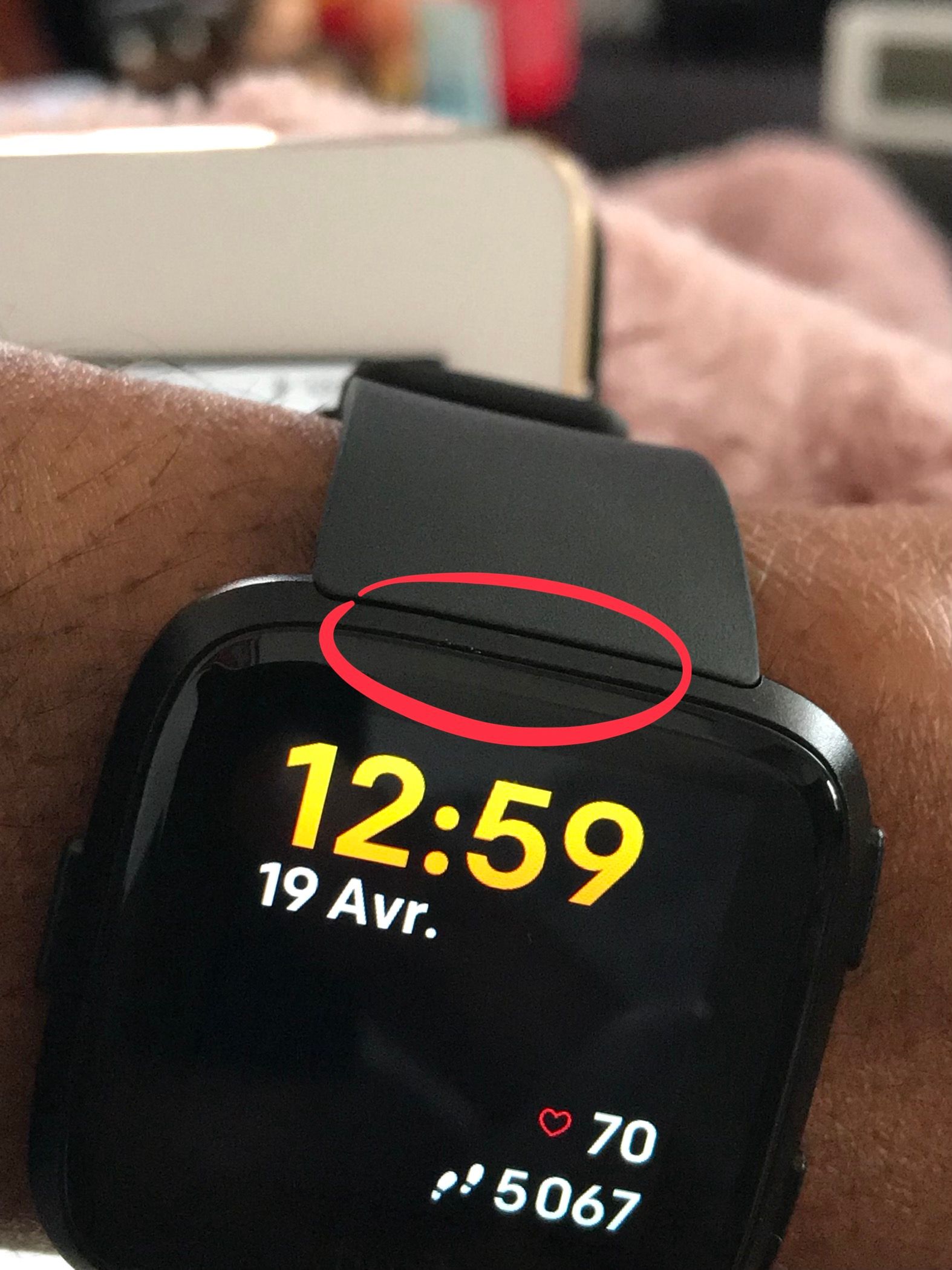 Versa Screen Scratches Fitbit Community