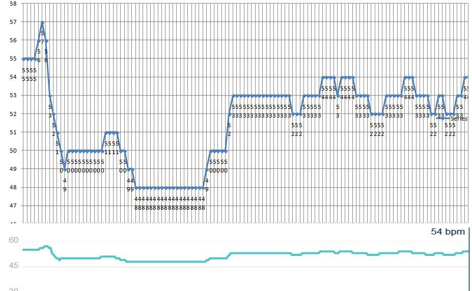 sleep HR 5 min 13may18.jpg