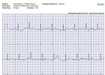 ecg 20may18.jpg