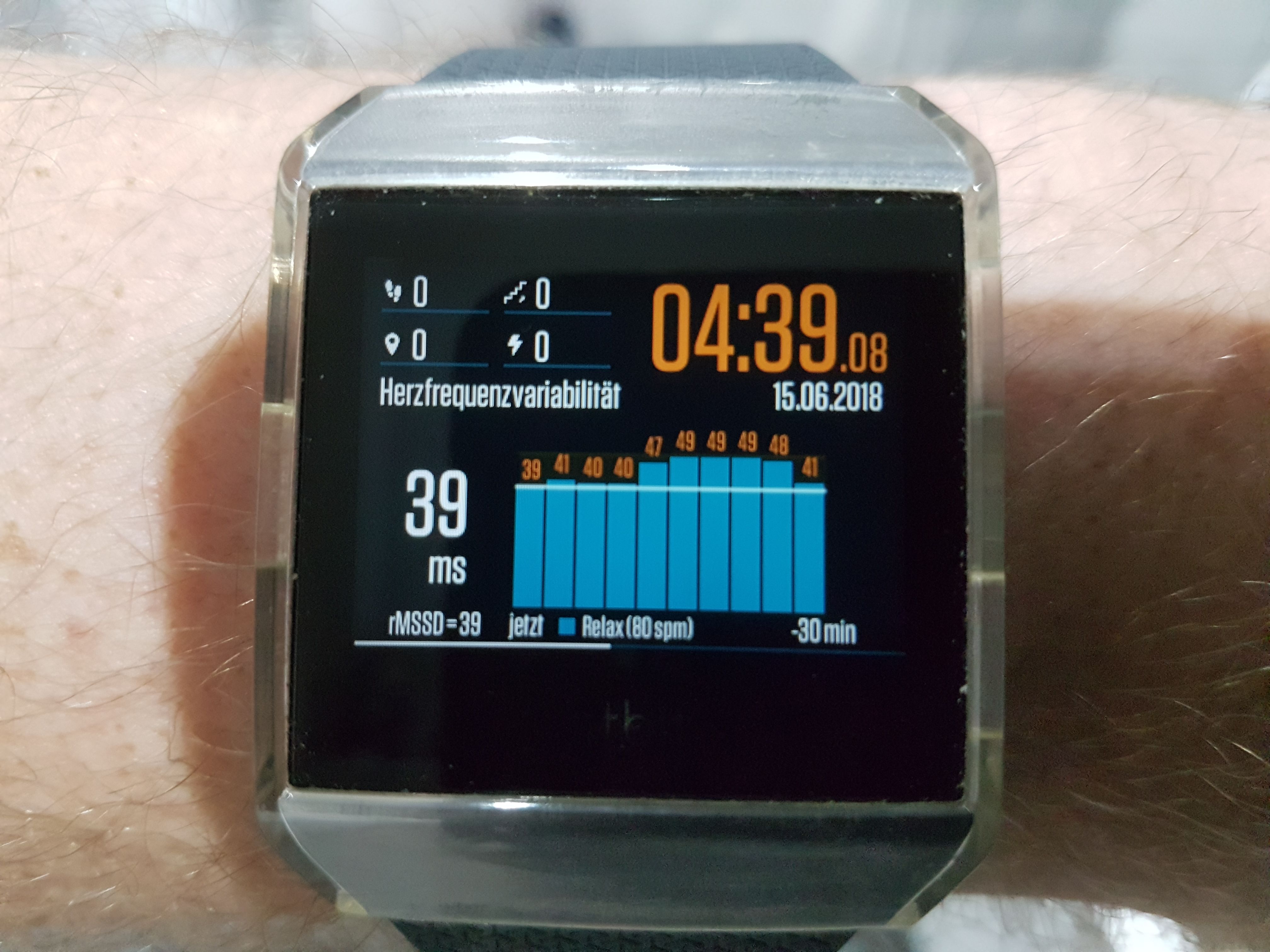 fitbit not showing sleep