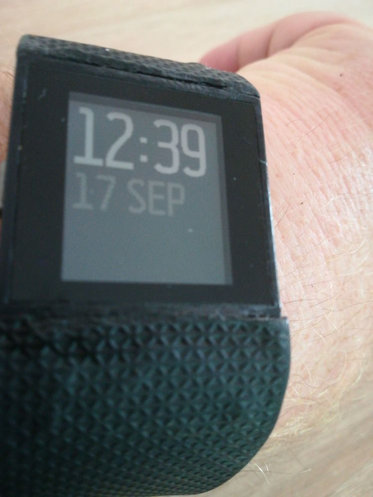 Ist natürlich nicht die beste Werbung für die Marke fitbit