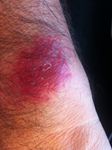 FitBit Force Burn