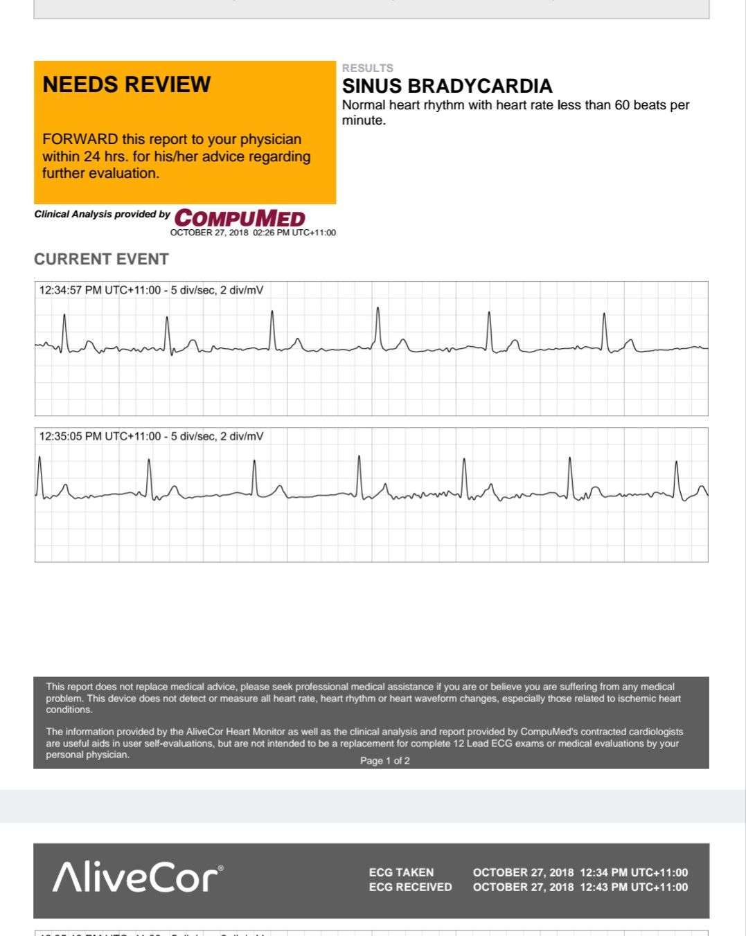 Fitbit with outlet ekg