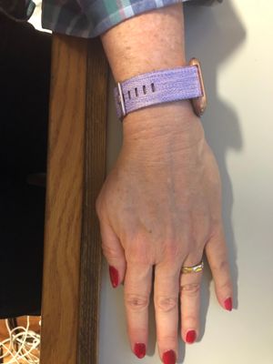 slides off to side of wrist