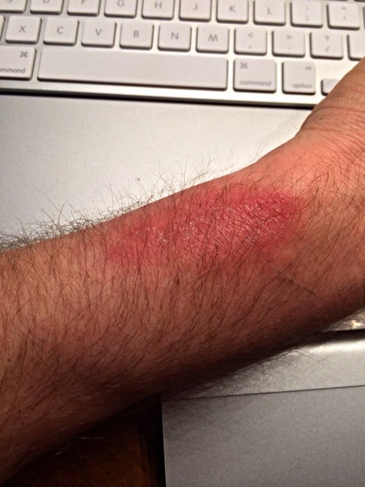 Forceburn