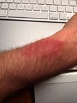 Forceburn