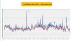 RHR Sleep HR 8feb19.jpg