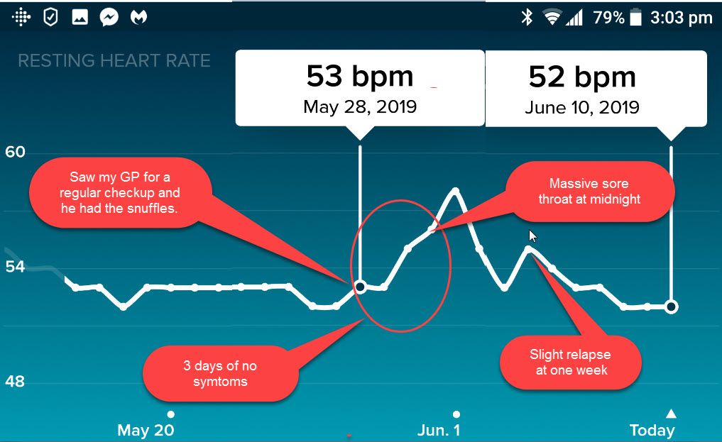 Fitbit resting heart online rate high